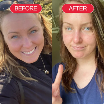 Korean Centella Premium Skincare Set (5 Pcs™)