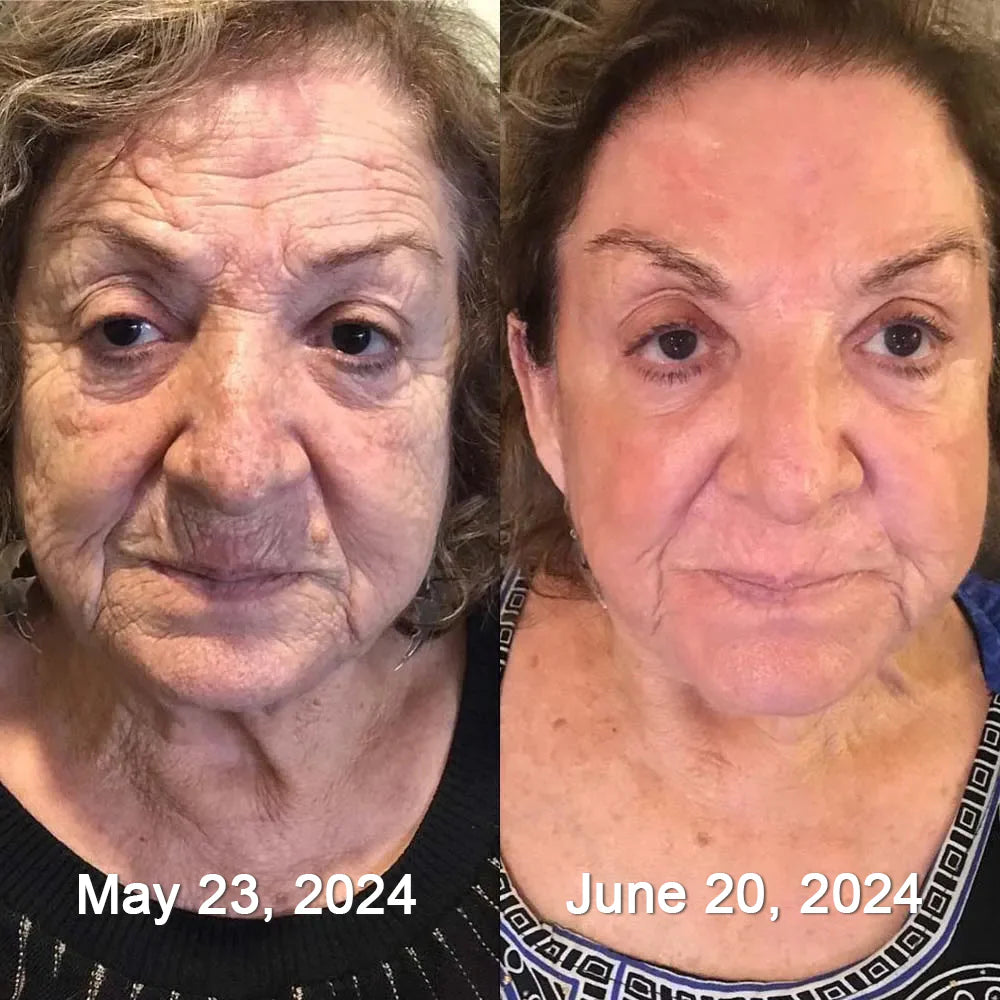 Glass Skin Retinol Refining Essence