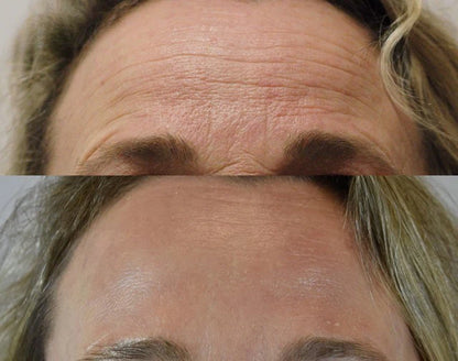 Korean Centella Premium Skincare Set (5 Pcs™)