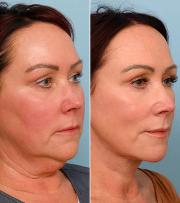 Customer experience – Olivia T.