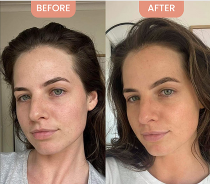 Korean Centella Premium Skincare Set (5 Pcs™)